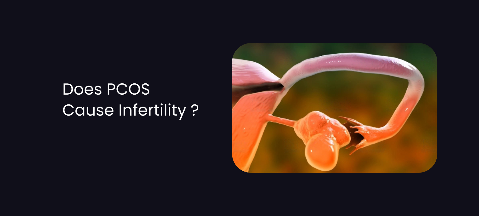 Does PCOS Cause Infertility?